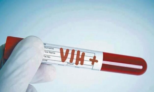 DESDE ENERO HASTA LA SEDES REGISTRÓ DOS DECESOS POR VIH/SIDA