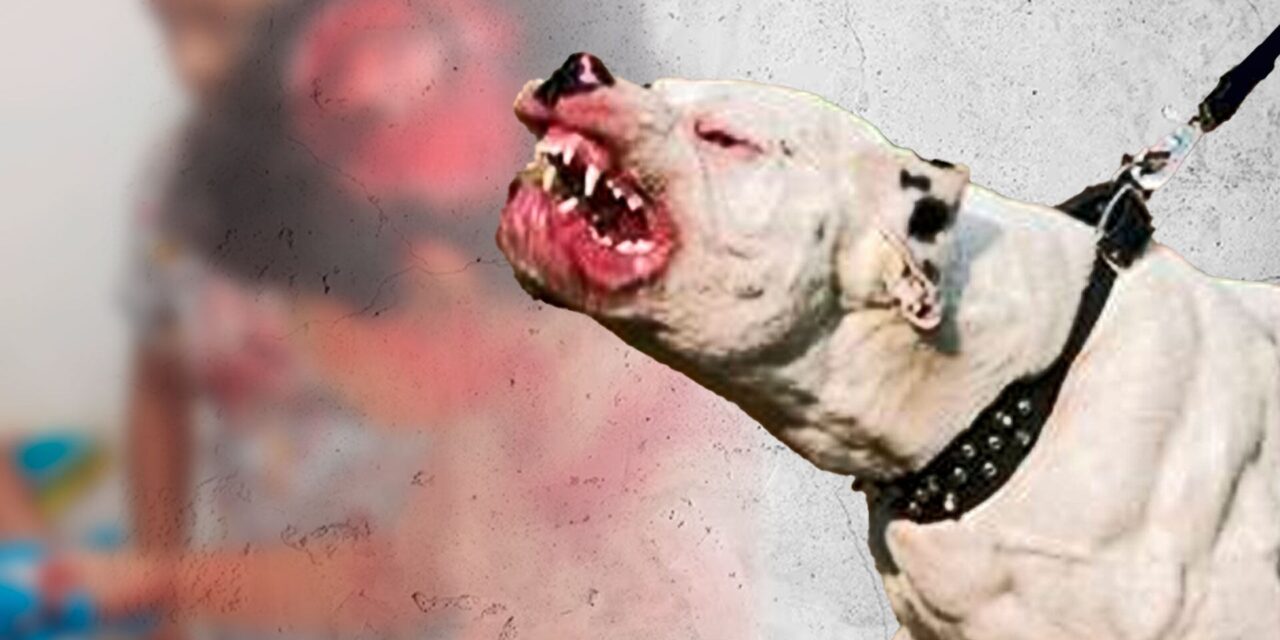 NIÑO DE 7 AÑOS FUE MORDIDO EN EL ROSTRO POR UN PERRO EN LA ZONA SAN ROQUE