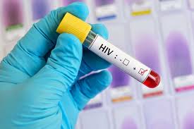 CDVIR REPORTA 35 NUEVOS CASOS DE VIH/SIDA EN LO QUE VA ESTE AÑO