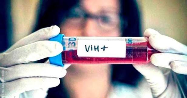 SEDES REPORTA DISMINUCIÓN DE CASOS DE VIH/SIDA EN LA PRESENTE GESTIÓN CON 37 NUEVOS CASOS
